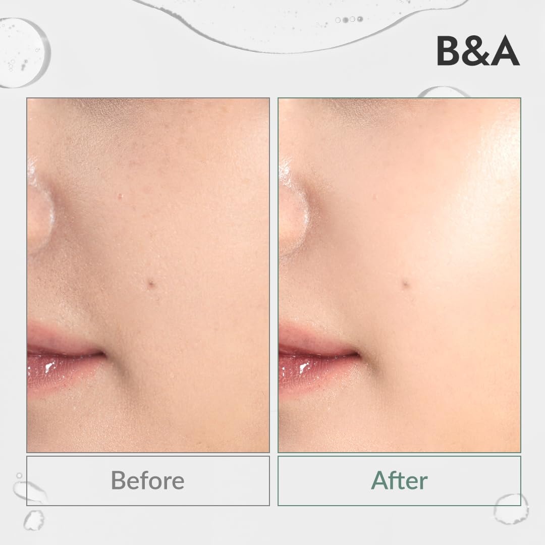image:imageMIZON Phyto Plump Collagen SERUM Vegan Collagen 88 natural ingredients with Adenosine Deep Hydration Korean Skincare 30 ml101 fl oz