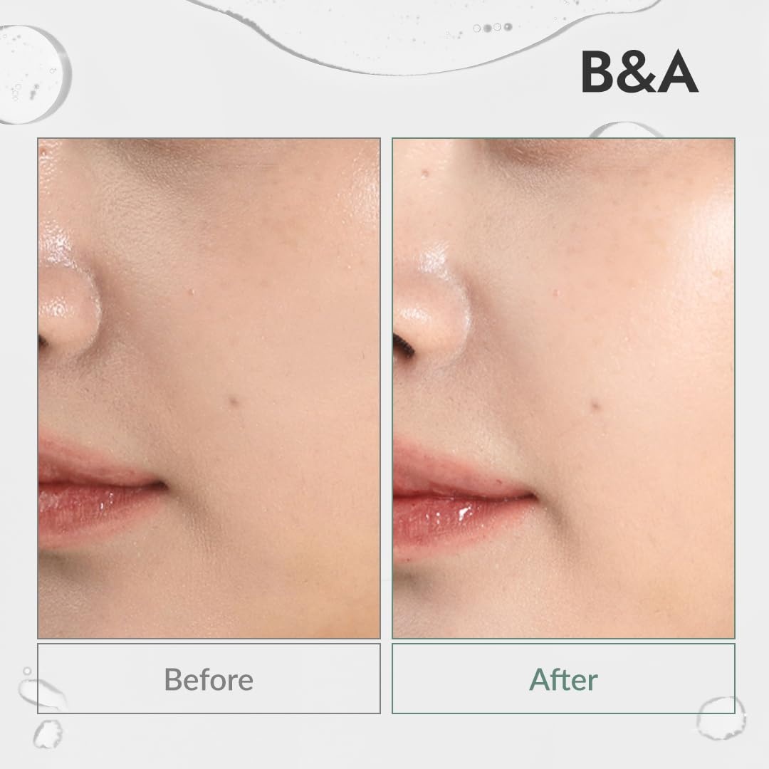 image:imageMIZON Phyto Plump Collagen TONER Plant Collagen with Adenosine Vegan Formula Hydrating AntiWrinkle Care 150 ml507 fl oz