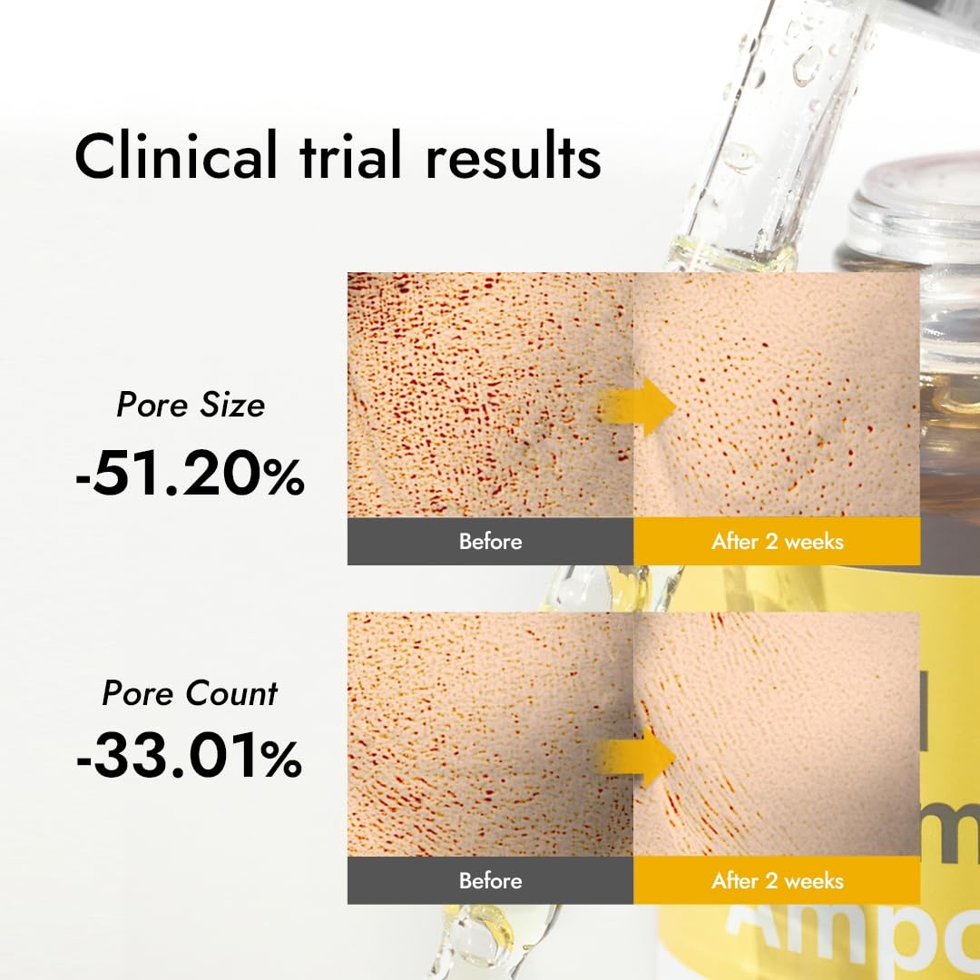 image:imageMIZON Real Vitamin C Ampoule Pure Vitamin C No Water Added10 Ingredients Nutrition Face Moisturizer 101 fl oz101 Fl Oz Pack of 1