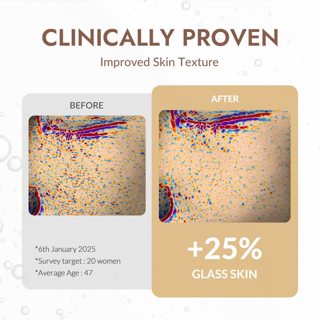 image:imageMIZON Snail Mucin Repair Ampoule Korean Snail Serum with Hyaluronic Acid Peptides amp Vitamin E Hydrating Snail Skincare for Elasticity amp Glass Skin Look 101 fl ozSnail